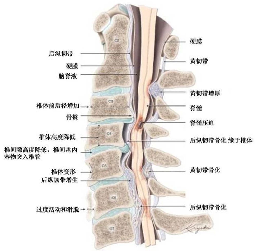 脊髓损伤分布图图片