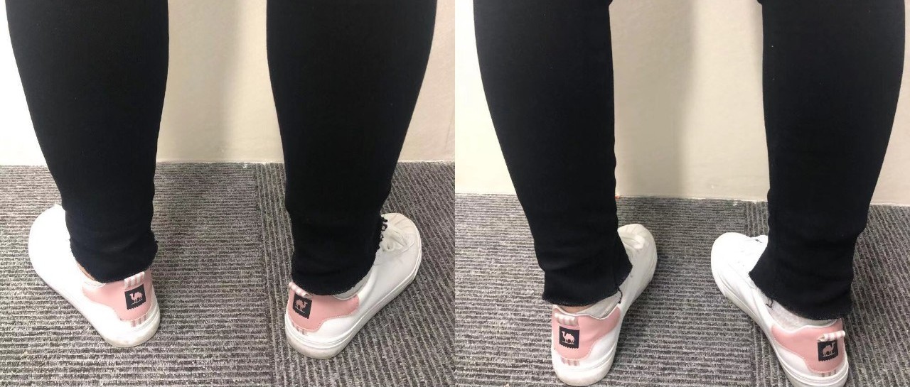 一套日常动作纠正你的"内八脚"和"外八脚"