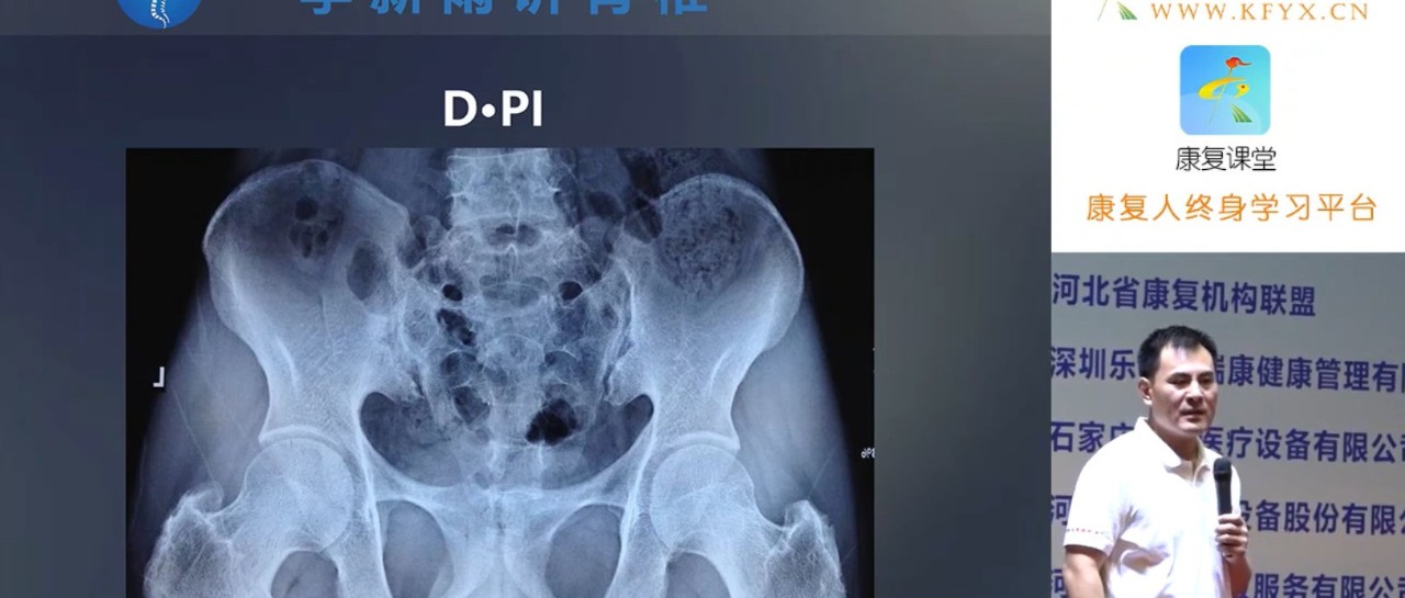 骨盆位置手法矫正,有效解决多种产后问题