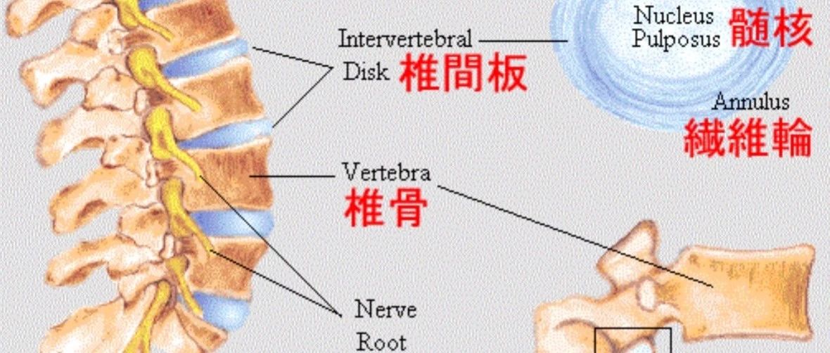 腰间盘突出有效康复合集,珍藏!