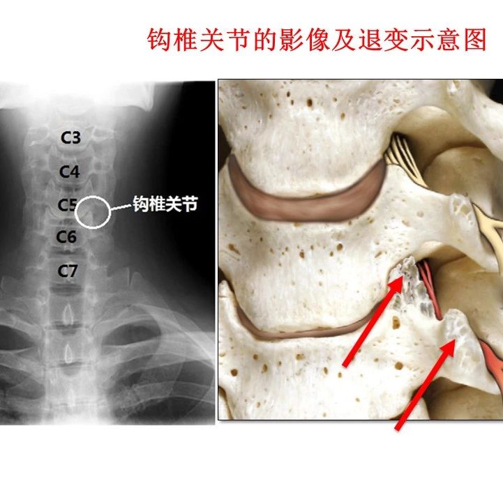 【康复应用解剖】颈椎