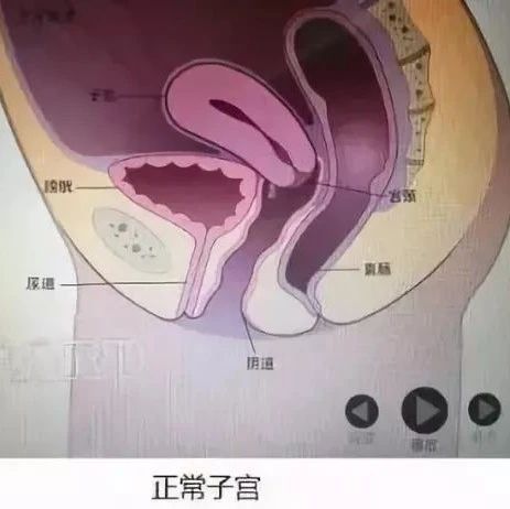 【精典课程】女性盆底精细解剖与康复实践,朱国苗老师亲授!