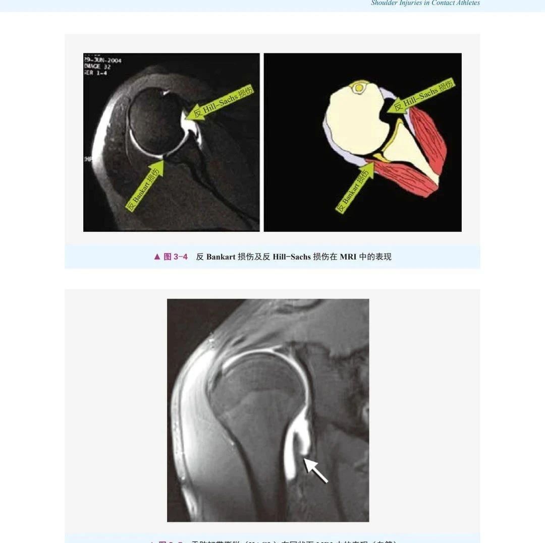 好书推荐|肩关节运动损伤,全面掌握肩关节康复治疗技术!