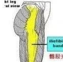 两个训练改善髂胫束磨擦综合症