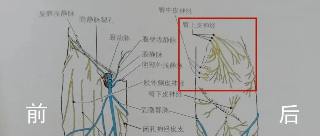 腰臀部弥漫性疼痛,可能是这条神经卡压了!