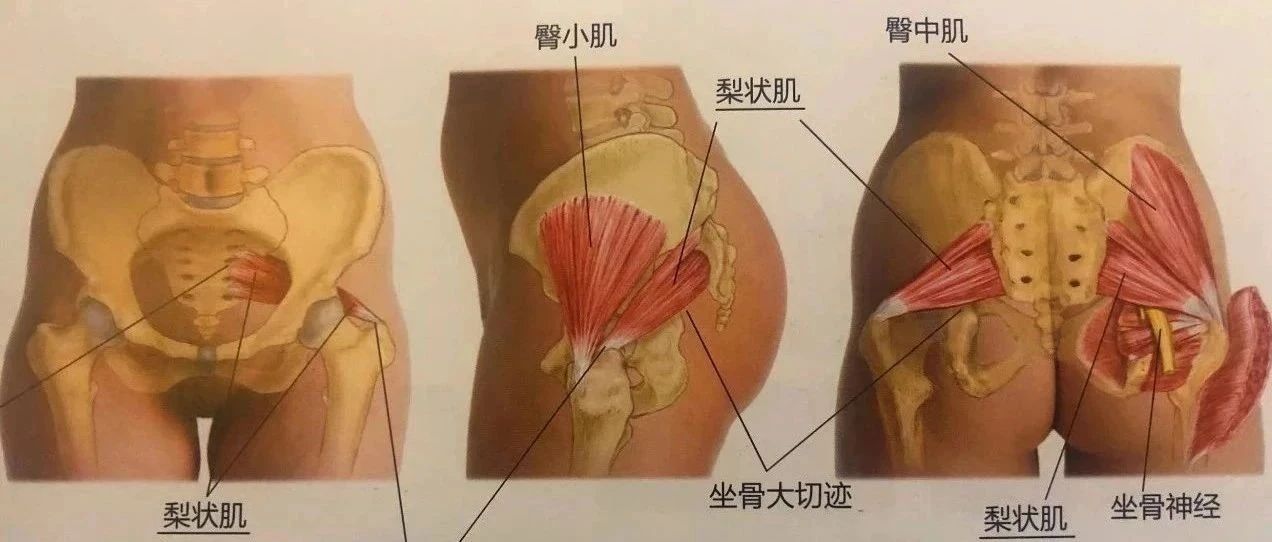 腰腿痛不一定是腰突!7种方法检查你的梨状肌