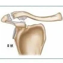 肩关节手法及训练指南,掌握肩关节常见疾病诊断及处理技术