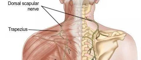 最容易忽视的颈肩痛——肩胛背神经卡压综合征!