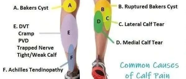 手法治疗师应该了解的小腿后肌群疼痛(Calfmuscles)常见原因