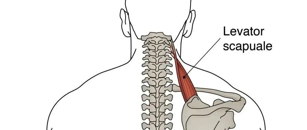 ​PT进阶:肩胛提肌的生物力学机制和激痛点