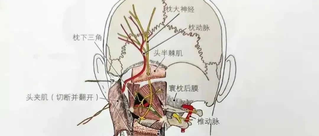 一咳嗽就头痛可能是枕大神经受损,处理时注意这5个关键点!