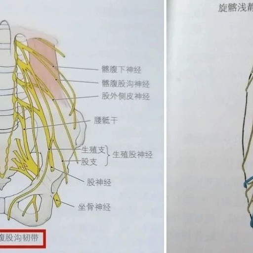 大腿前外侧痛是腰椎间盘突出?很多人都错了……