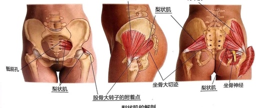 别再让腰间盘背锅了!腿麻臀痛的“元凶”可能是它~