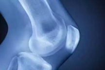 【学习通知】10月26-28日/朱国苗/下肢部系统评估与精准康复治疗高级班